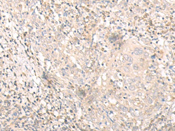 IL24 Polyclonal Antibody (E-AB-17913)