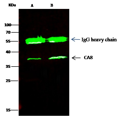 Recombinant Carbonic Anhydrase VIII/CA8 Monoclonal Antibody (AN300188P)