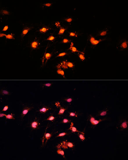 GTF3C4 Polyclonal Antibody (E-AB-63949)