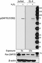 Purified anti-ZAP70 Phospho (Tyr292) Antibody (691902)