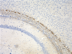 Anti-Neurofilament H & M (NF-H/NF-M), Hypophosphorylated Antibody (Previously Covance catalog# SMI-35R) (835601)