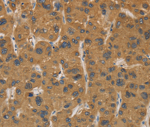 CYP17A1 Polyclonal Antibody (E-AB-11124)
