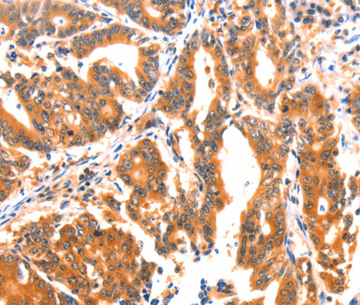 AK5 Polyclonal Antibody (E-AB-13038)