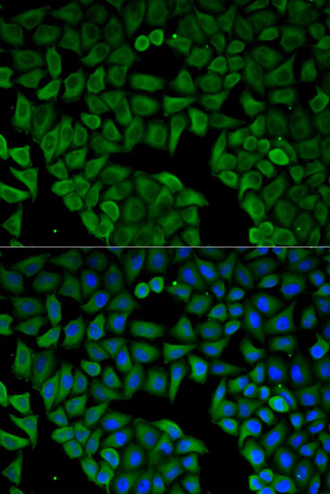CHRNA1 Polyclonal Antibody (E-AB-66042)