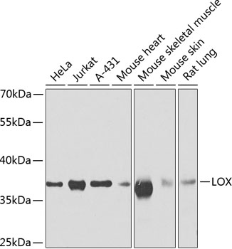 LOX Polyclonal Antibody (E-AB-62819)