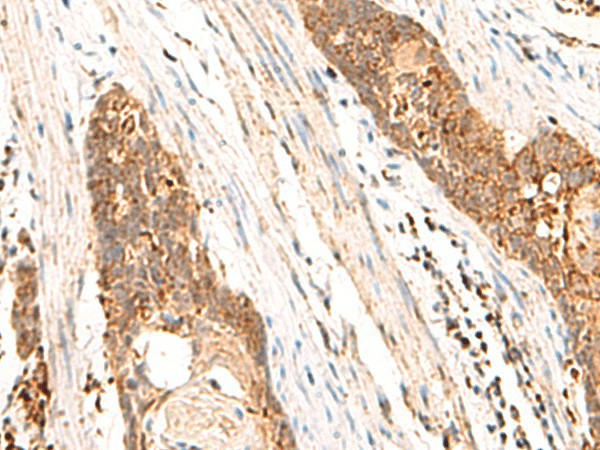 CYYR1 Polyclonal Antibody (E-AB-18980)