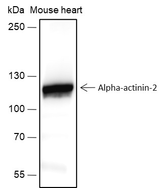 Recombinant alpha Actinin 2 Monoclonal Antibody (AN301755L)