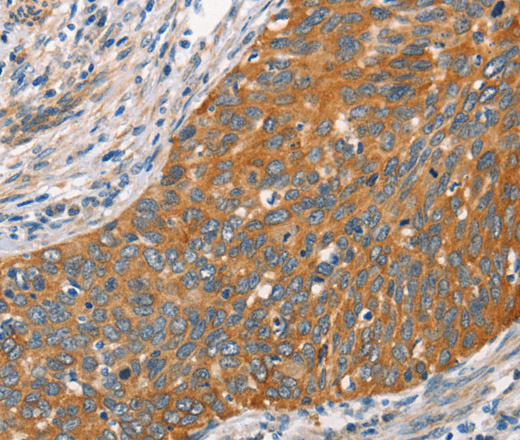 Crystallin-alpha C Polyclonal Antibody (E-AB-10378)