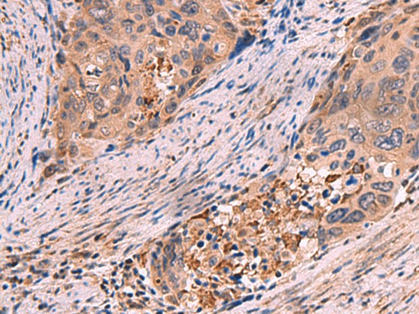 SHC4 Polyclonal Antibody (E-AB-19079)