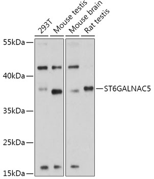 ST6GALNAC5 Polyclonal Antibody (E-AB-91908)