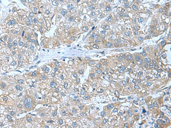 SRPK2 Polyclonal Antibody (E-AB-53007)