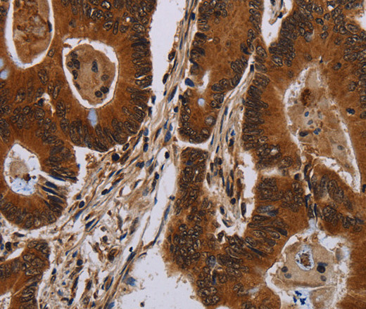 DCAF6 Polyclonal Antibody (E-AB-16662)
