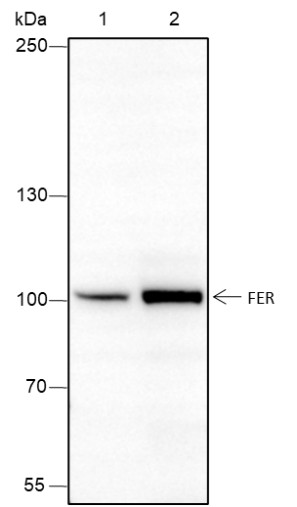 Recombinant FER Monoclonal Antibody (AN301713L)