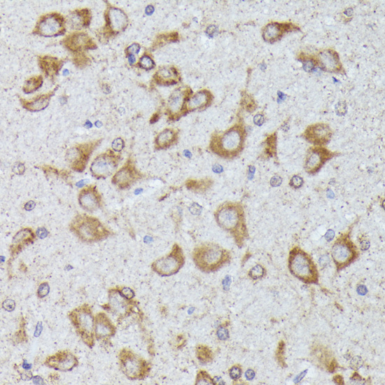 TBCB Polyclonal Antibody (E-AB-64516)