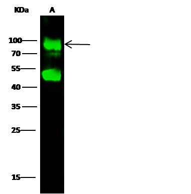 Recombinant Glucosamine (N-acetyl)-6-Sulfatase/G6S Monoclonal Antibody (AN300183P)