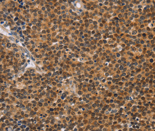 CD36 Polyclonal Antibody (E-AB-16315)