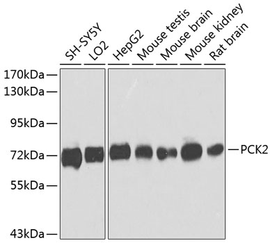 PCK2 Polyclonal Antibody (E-AB-62856)