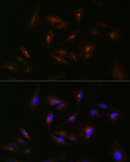 ABCA2 Polyclonal Antibody (E-AB-66920)