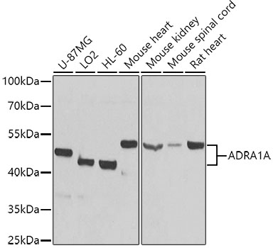 ADRA1A Polyclonal Antibody (E-AB-62002)