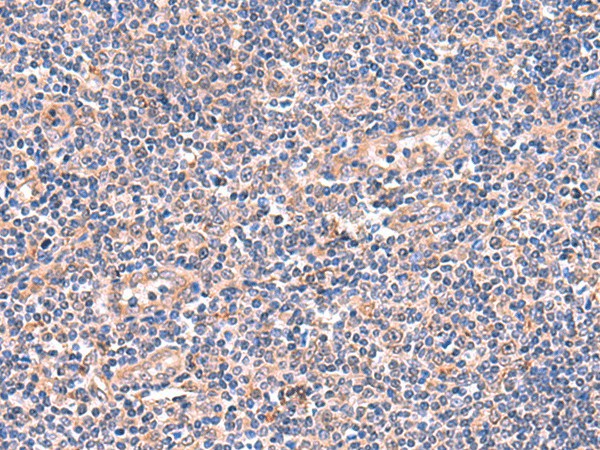 OSBPL2 Polyclonal Antibody (E-AB-19059)