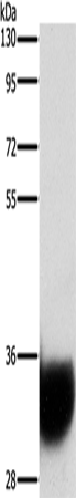 GPM6A Polyclonal Antibody (E-AB-14718)