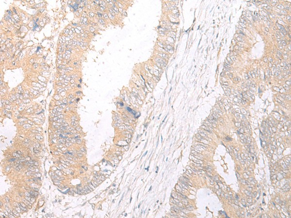HLA-C Polyclonal Antibody (E-AB-17922)