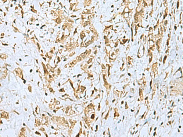 HOXC9 Polyclonal Antibody (E-AB-53448)