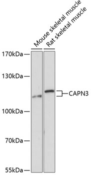 CAPN3 Polyclonal Antibody (E-AB-64116)