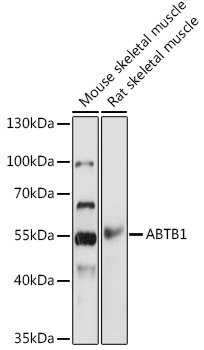 ABTB1 Polyclonal Antibody (E-AB-92073)