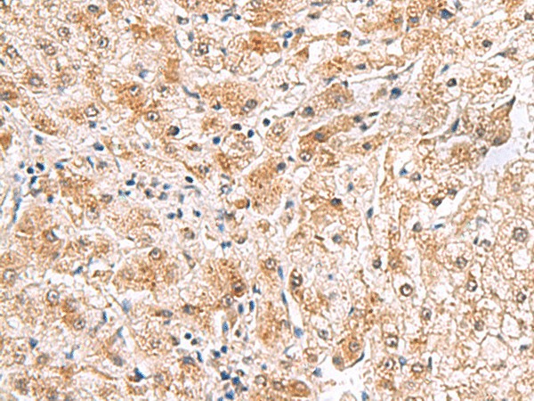 PDCL2 Polyclonal Antibody (E-AB-18954)