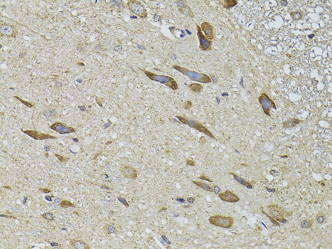 ADRBK2 Polyclonal Antibody (E-AB-60575)