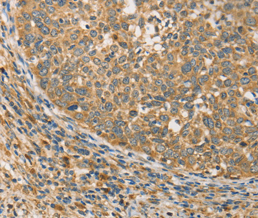 ATG3 Polyclonal Antibody (E-AB-10813)