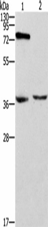 ZAP70 Polyclonal Antibody (E-AB-53218)