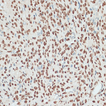 PGR Polyclonal Antibody (E-AB-64004)