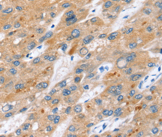 ERVW-1 Polyclonal Antibody (E-AB-13709)