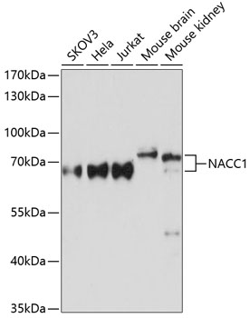 NACC1 Polyclonal Antibody (E-AB-64094)