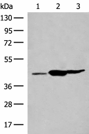 GPR22 Polyclonal Antibody (E-AB-19931)