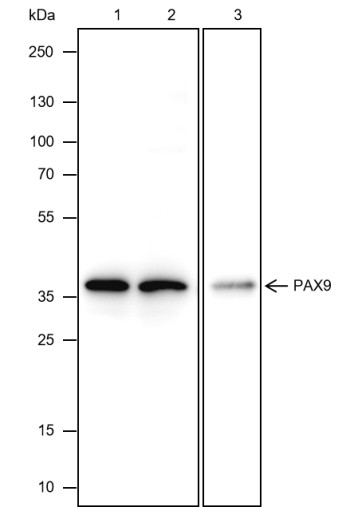Recombinant PAX9 Monoclonal Antibody (AN301703L)