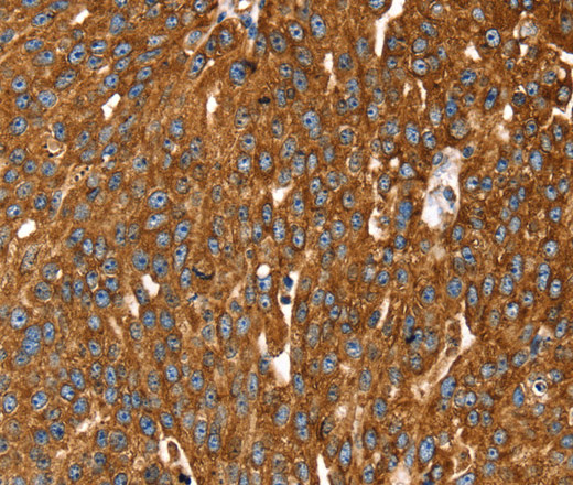 RASSF3 Polyclonal Antibody (E-AB-15334)