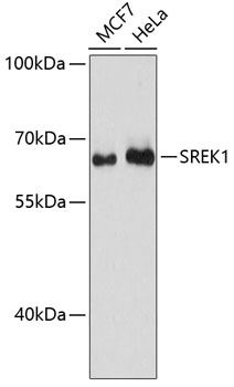 SREK1 Polyclonal Antibody (E-AB-64511)