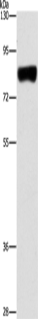 ARHGAP25 Polyclonal Antibody (E-AB-14605)