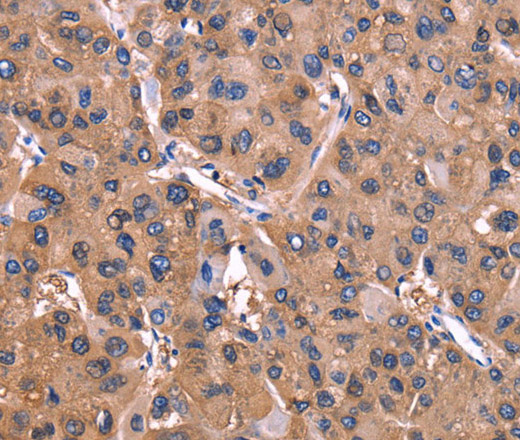 ADM2 Polyclonal Antibody (E-AB-12227)