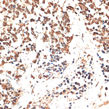 MCM5 Polyclonal Antibody (E-AB-64688)