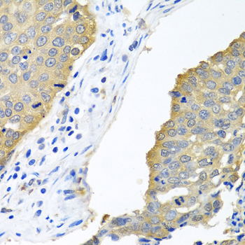 (KO Validated) EIF4E Polyclonal Antibody (E-AB-60650)