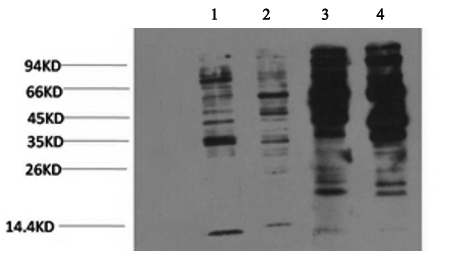 Phosphotyrosine Monoclonal Antibody (E-AB-21335)