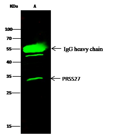 Recombinant Pancreasin/Marapsin/PRSS27 Monoclonal Antibody (AN300100P)