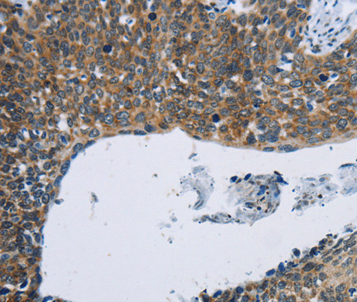 KPNB1 Polyclonal Antibody (E-AB-13334)