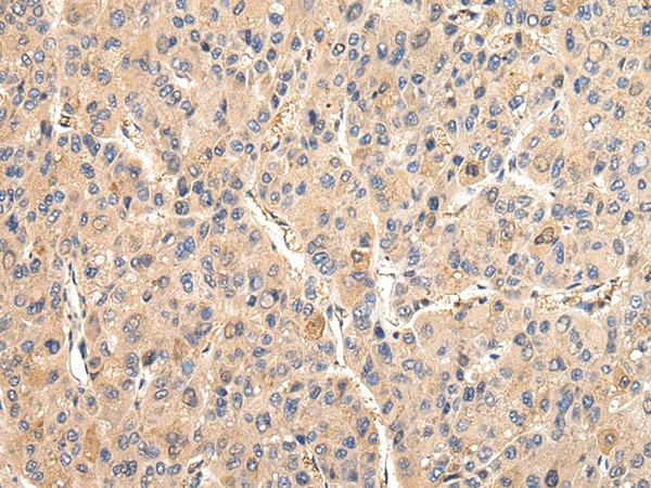 VCAM1 Polyclonal Antibody (E-AB-17252)