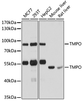 (KO Validated) TMPO Polyclonal Antibody (E-AB-60715)