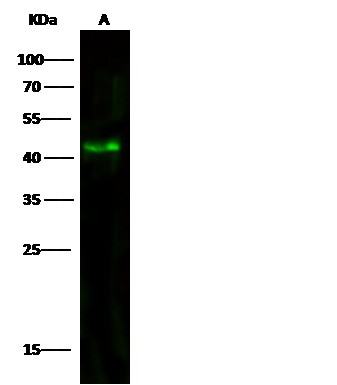 ACY1/Aminoacylase-1 Monoclonal Antibody (AN200180P)